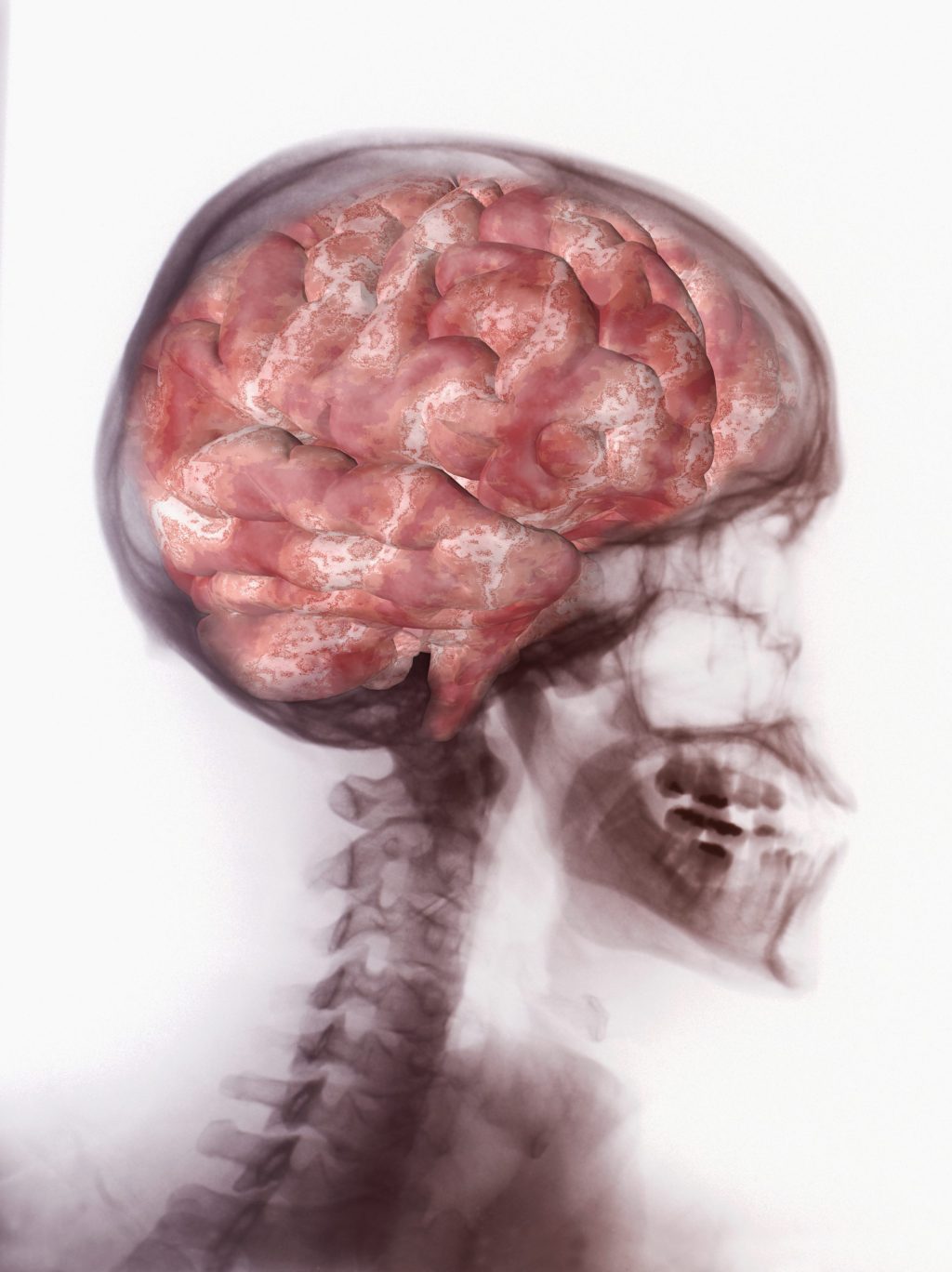 Artistic illustration symbolizing the effects of trauma on the brain